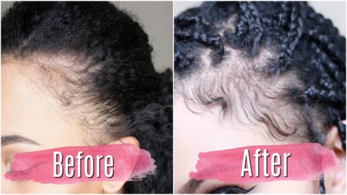Wild Growth Hair Oil Before and After